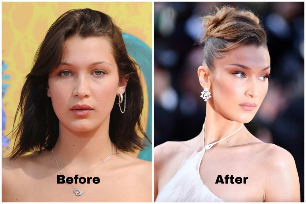 Bella Hadid Before And After The Model S Biography And Lyme Disease Struggle Yen Gh