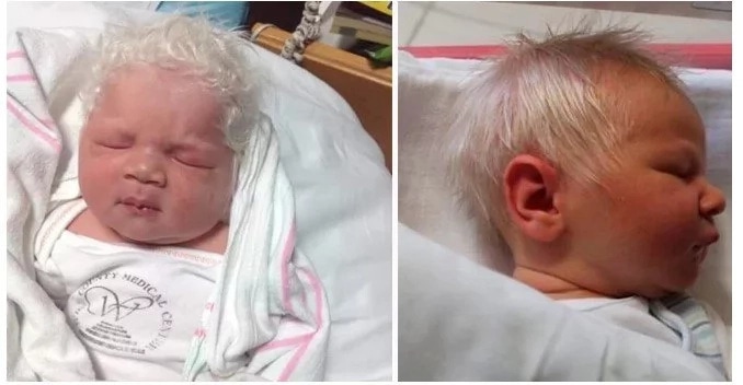 Gray-Haired Baby Born and is Adorable!