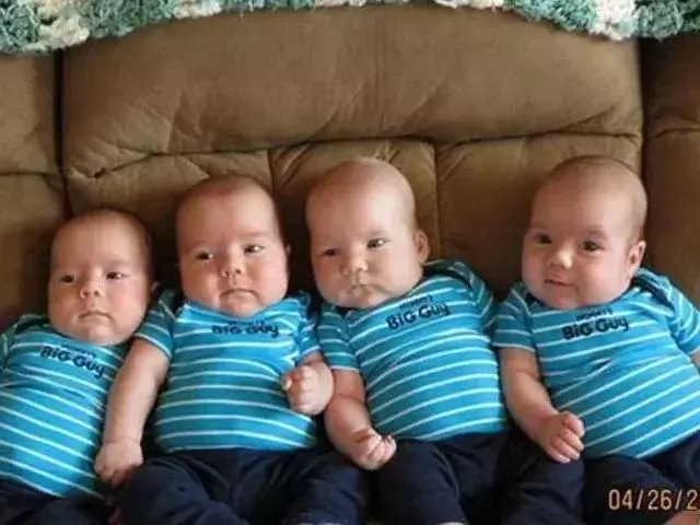 Woman gives birth to 4 babies at once, but they're unusual quadruplets