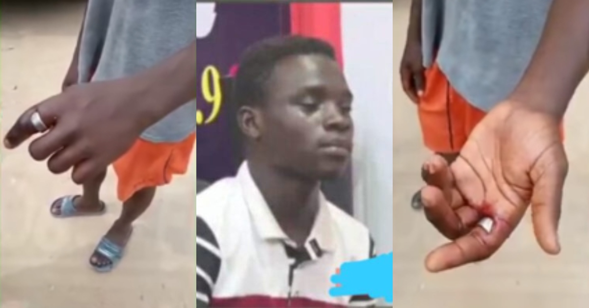 A Powerful Mallam has Removed it for me - Boy who wore 'Sakawa' ring & was Losing Finger says