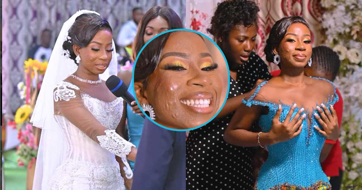 Ghanaian midwife with severe acne opts for mild makeup for her plush wedding: "Too much stress"