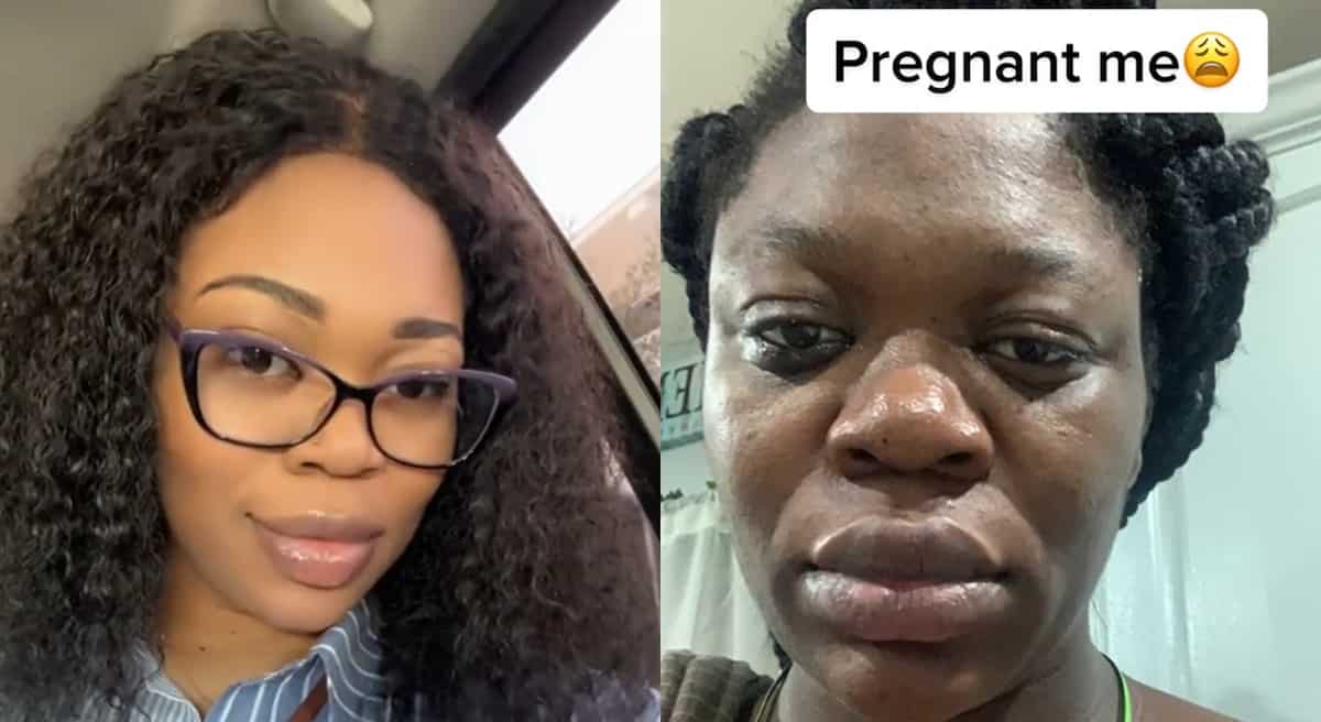 "Pregnancy is no joke": Lady shows a big nose and dark skin she got after having her 1st child