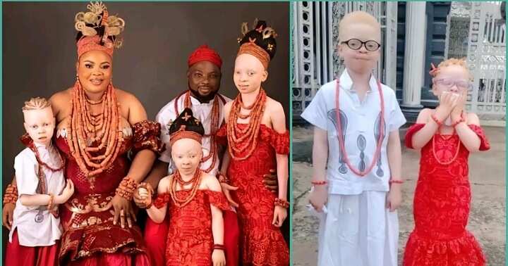 Couple with three 'albino' children goes viral on TikTok
