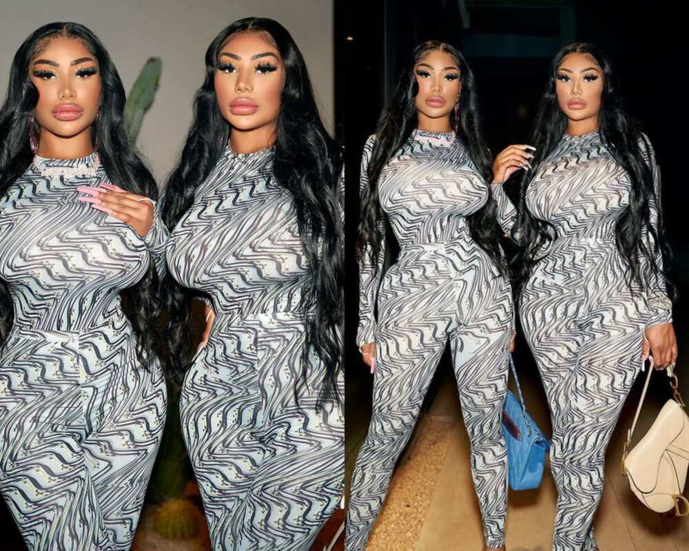 What surgery did the Clermont twins get?