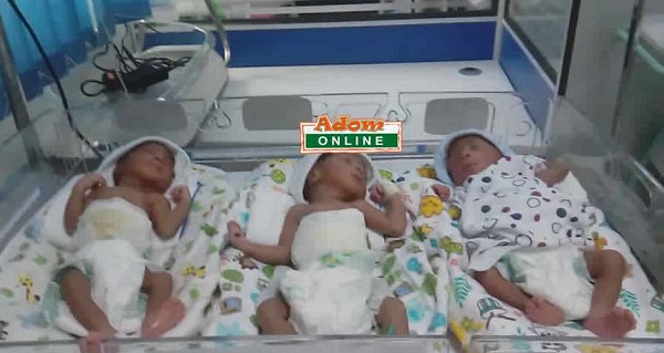 45-year-old woman delivers quintuplets after 20 years of marriage without a child