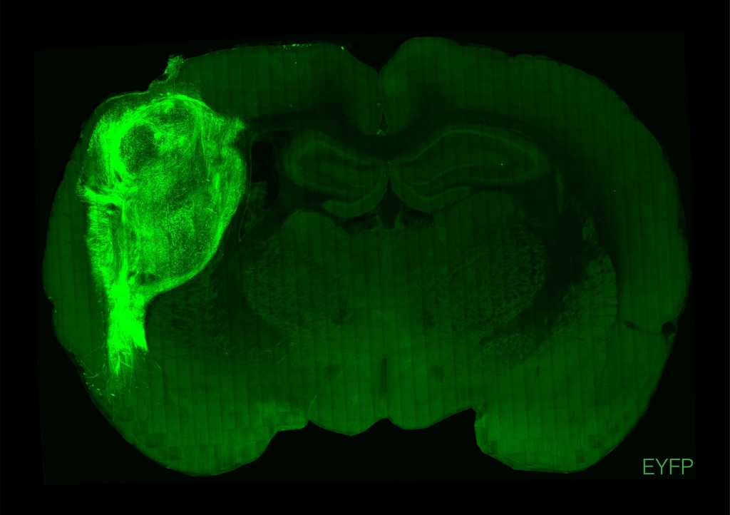 The brain of a rat in which a fluorescent protein has been used to highlight transplanted human brain cells