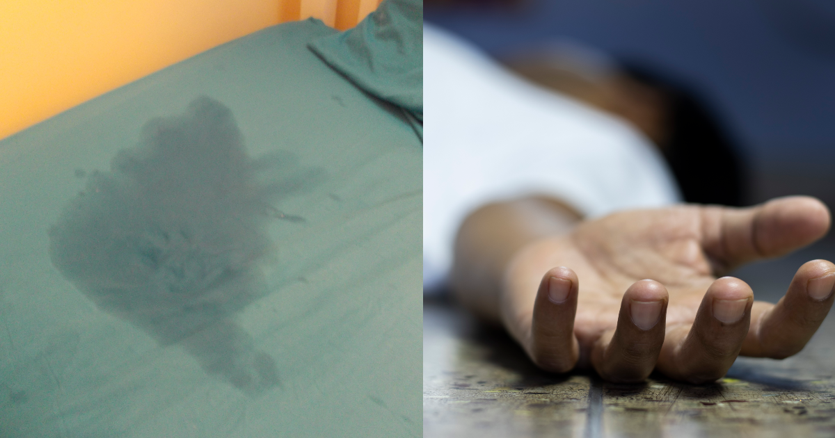 Parents beat child over bed wetting