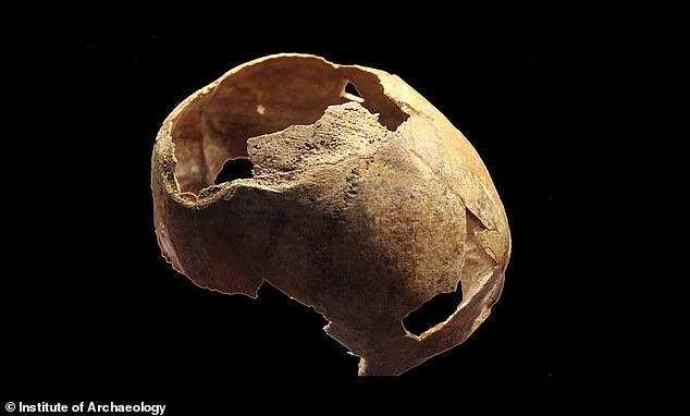 The trepanation measured about 140 × 125 millimeters. Photo: Institute of Archaeology