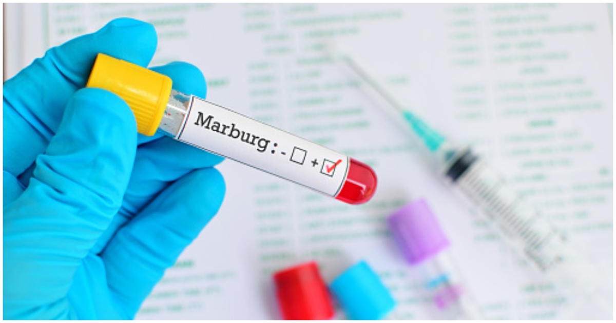 Ghana soon to be declared 'Marburg virus free'