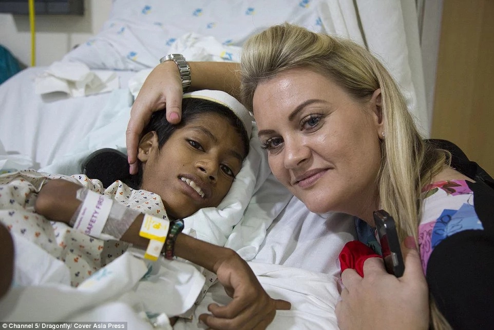 Photos: Boy with upside down head gets life-changing surgery