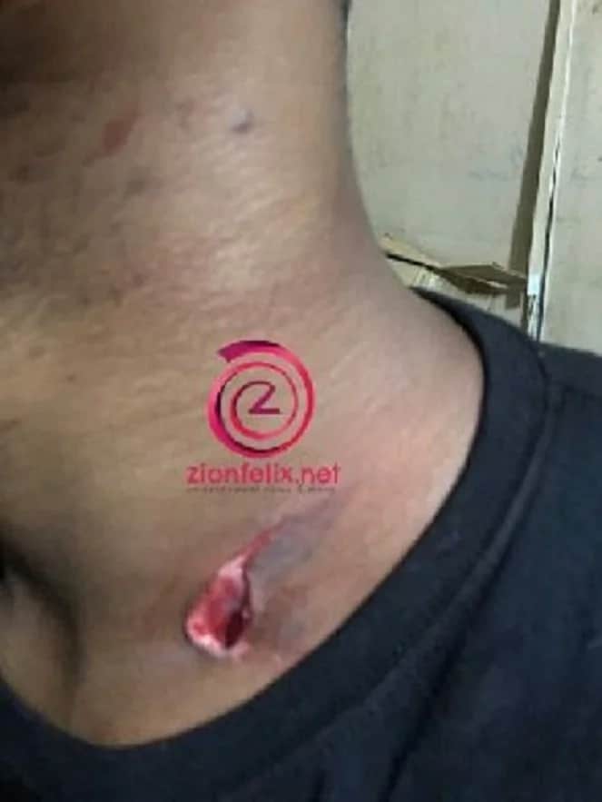 Movie producer's neck showing a stab wound
