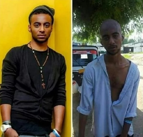 PHOTOS: See how Tanzanian Big Brother Africa contestant Nando has been destroyed by drug abuse