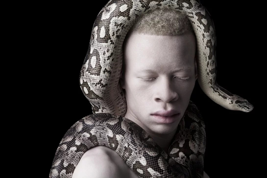 Meet 7 supermodels who are albinos