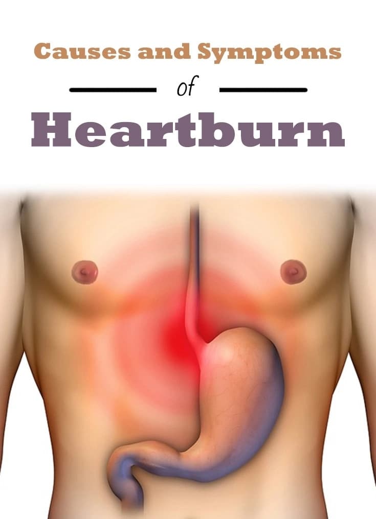 Symptoms and causes of heartburn