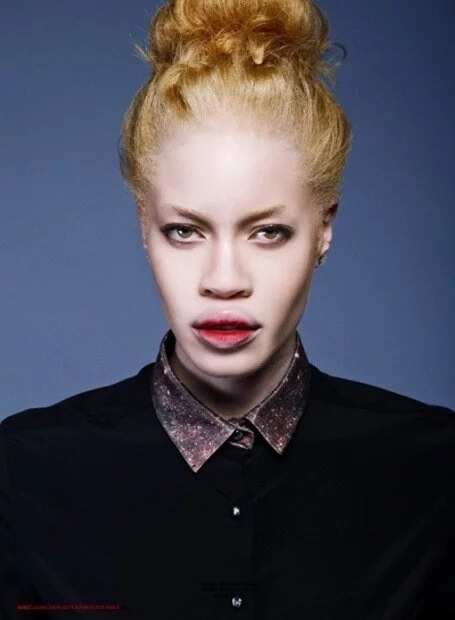 Meet 7 supermodels who are albinos