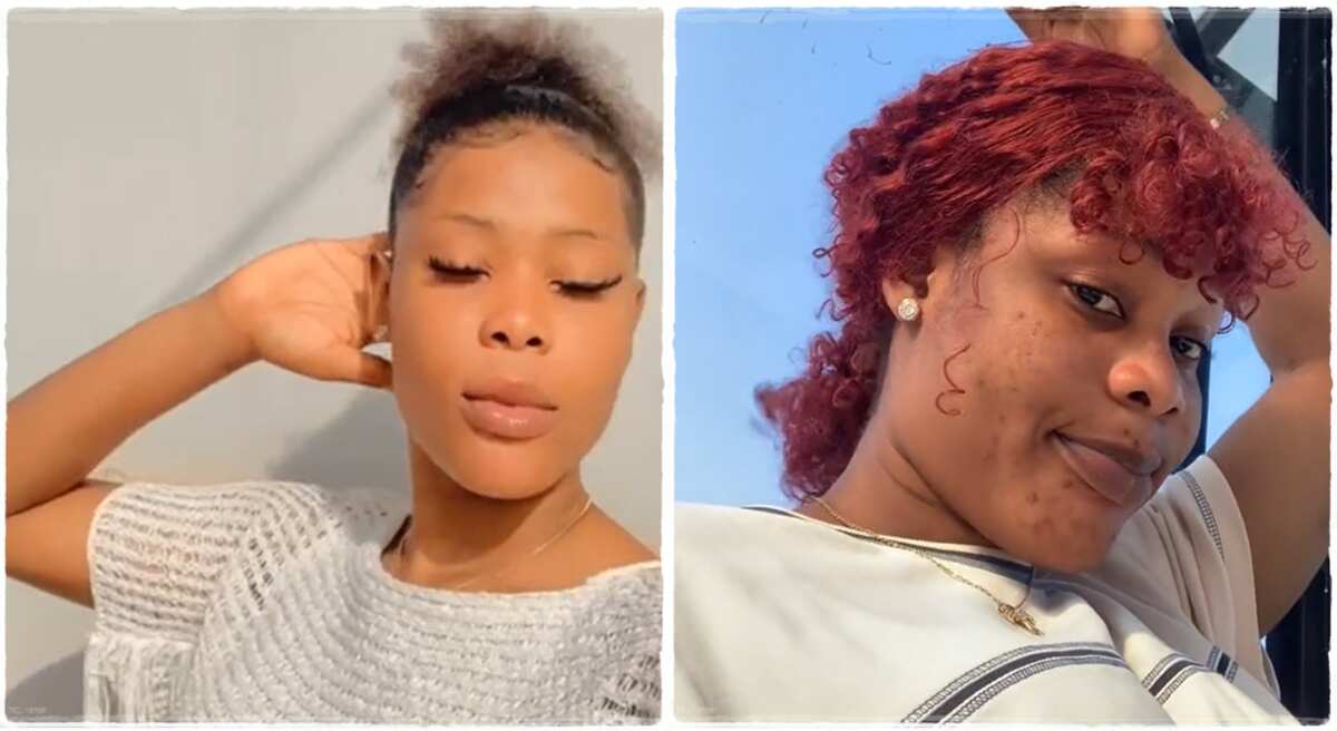 Photos of a Nigerian lady who suffered a skin damage in Canada.