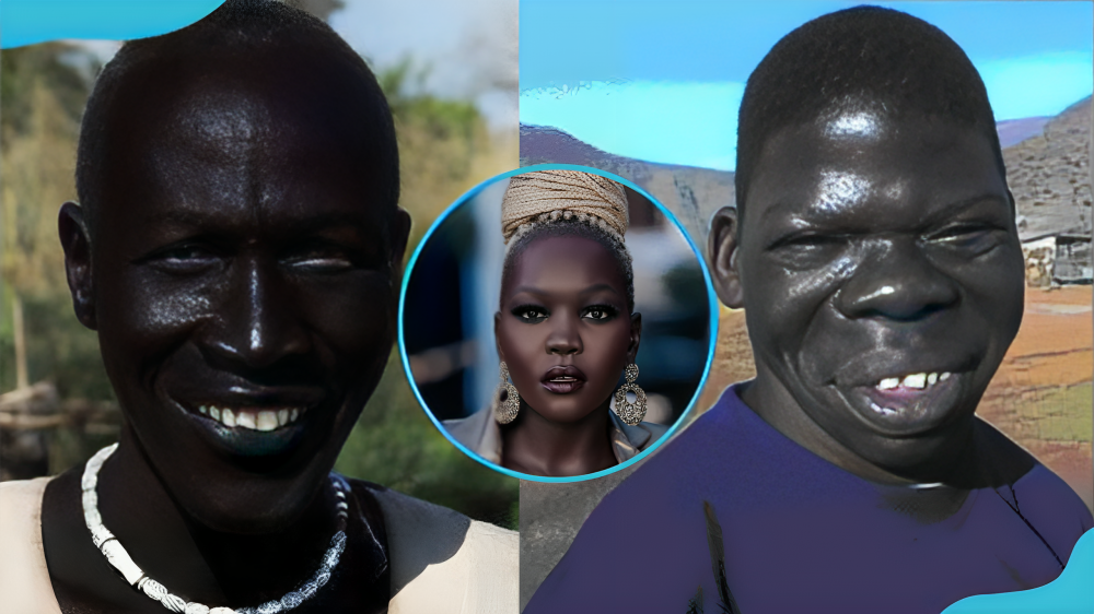 Who is the blackest person in the world, and is there a Guinness World Record for it?