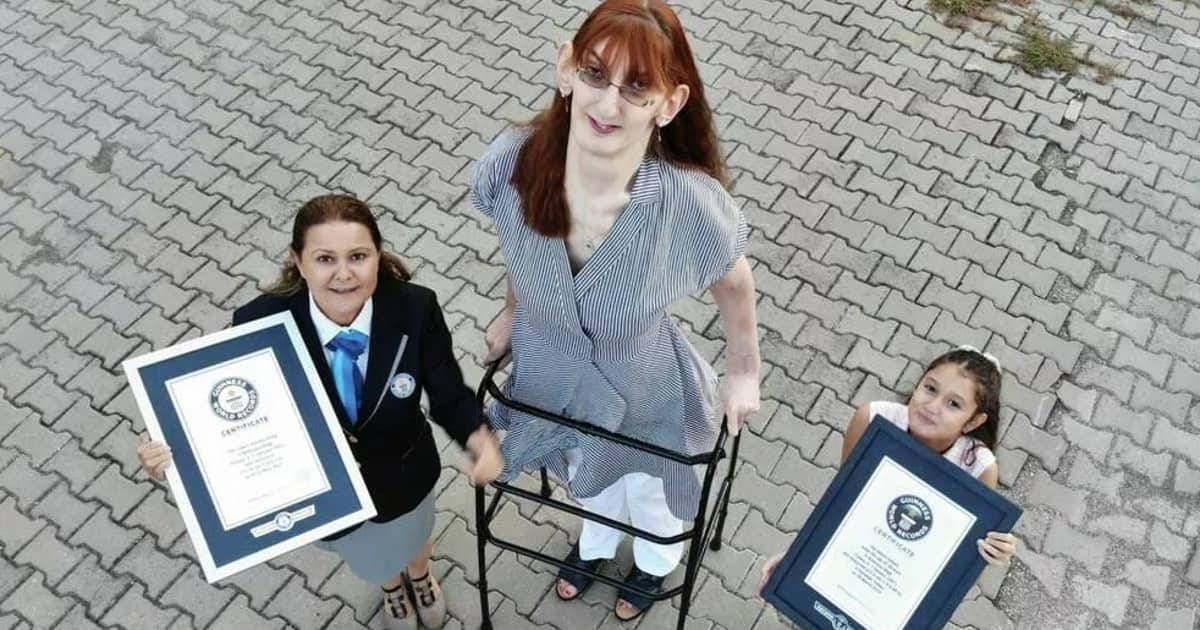 Rumeysa Gelgi is the World's Tallest Living Woman.