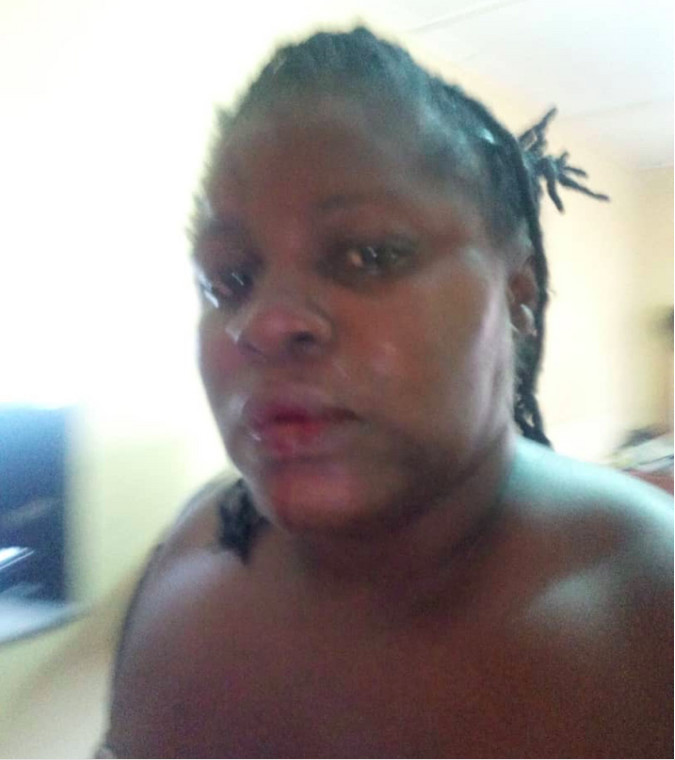 Abused former wife of former news editor of Joy FM and Citi FM tells story and shares photos