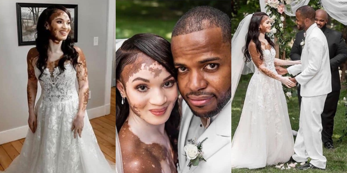 Beautiful wedding photos of man and his bride with a unique skin break the internet (Photos)