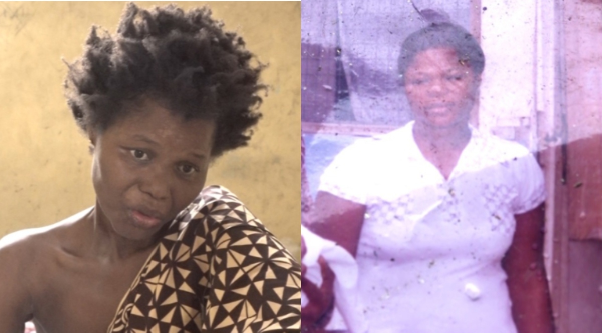 Ghanaian lady with breast cancer needs help as landlord wants her out over bad smell