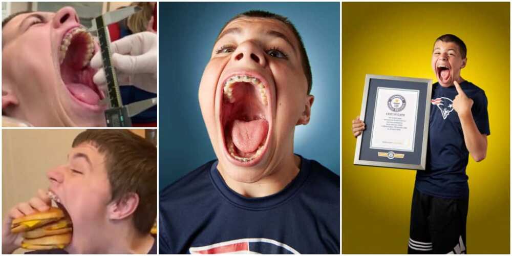 Teenage boy reclaims Guinness World Record of having the widest mouth gape