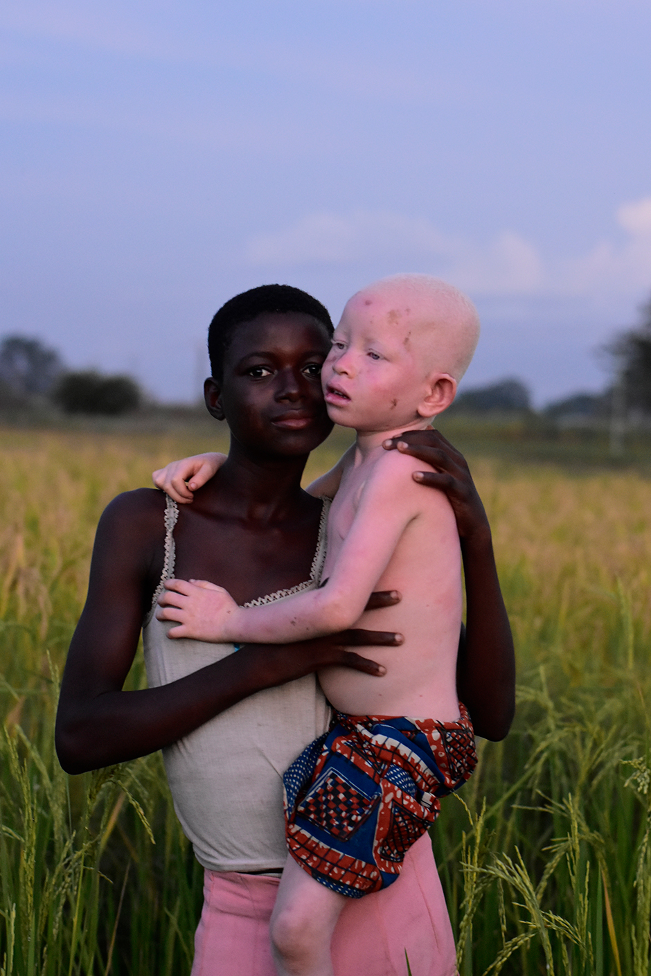 Photographer grabs over GHC30,000 cash prize after releasing photo of albino girl
