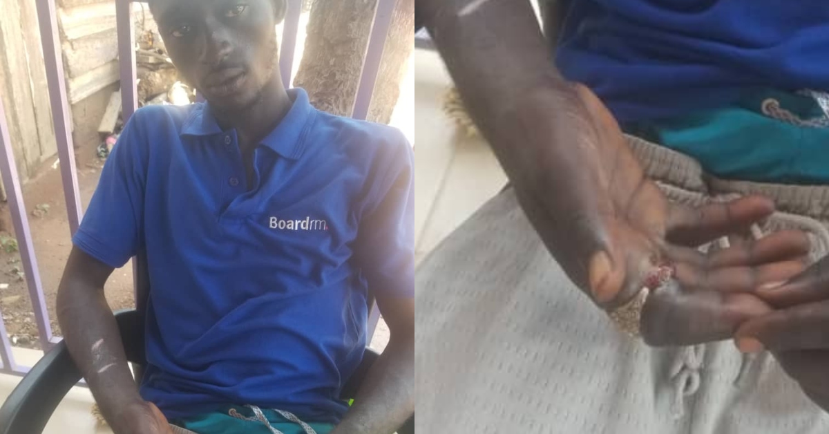 Seth Omari Boateng: New teenager's finger decaying after putting on spiritual ring he stole at Pantang