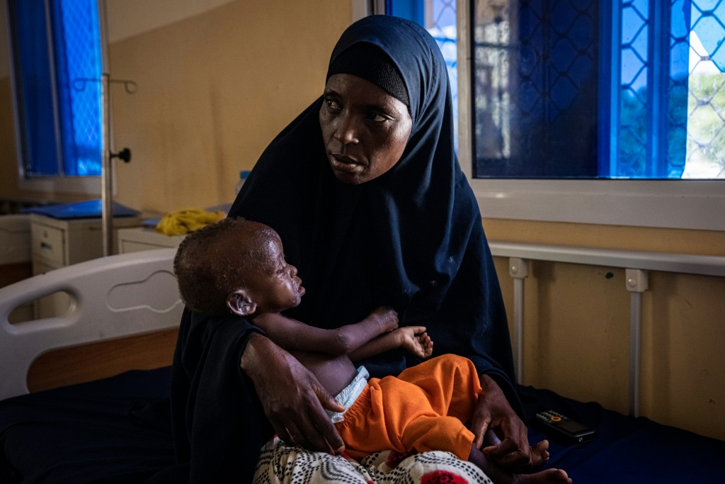 Hunger crisis: A mother and her malnourished baby at the Banadir Maternity and Children Hospital in Mogadishu