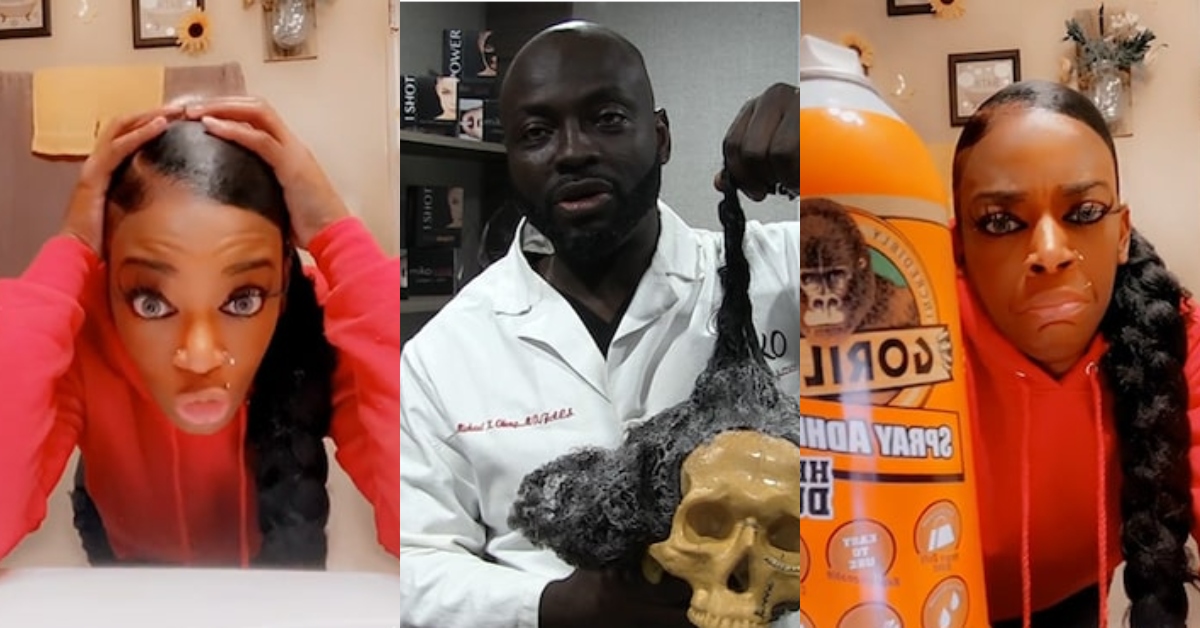 Dr Michael Obeng: Ghanaian surgeon removes Gorilla Glue Tessica Brown’s head