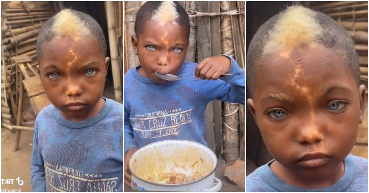 boy with natural blue eyes, lightening mark on face & white frontal hairs, boy with light eyes goes viral