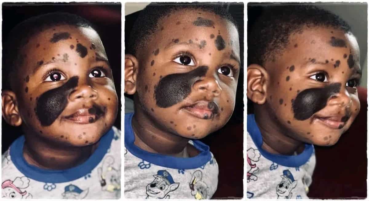 "He looks very unique": Handsome boy with black marks on his face trends online as cute photos emerge