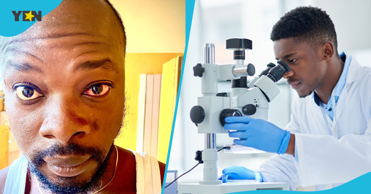 'Apollo' Cases: Ghanaians Cautioned About Fast-Spreading Of Acute Hemorrhagic Conjunctivitis In Ghana