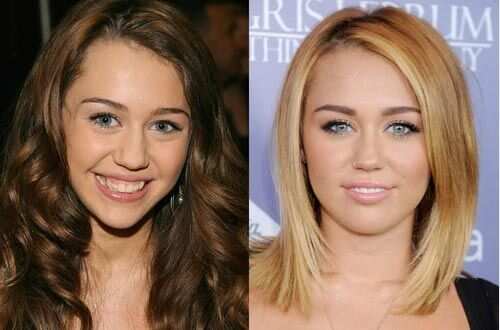 celebrities without noses