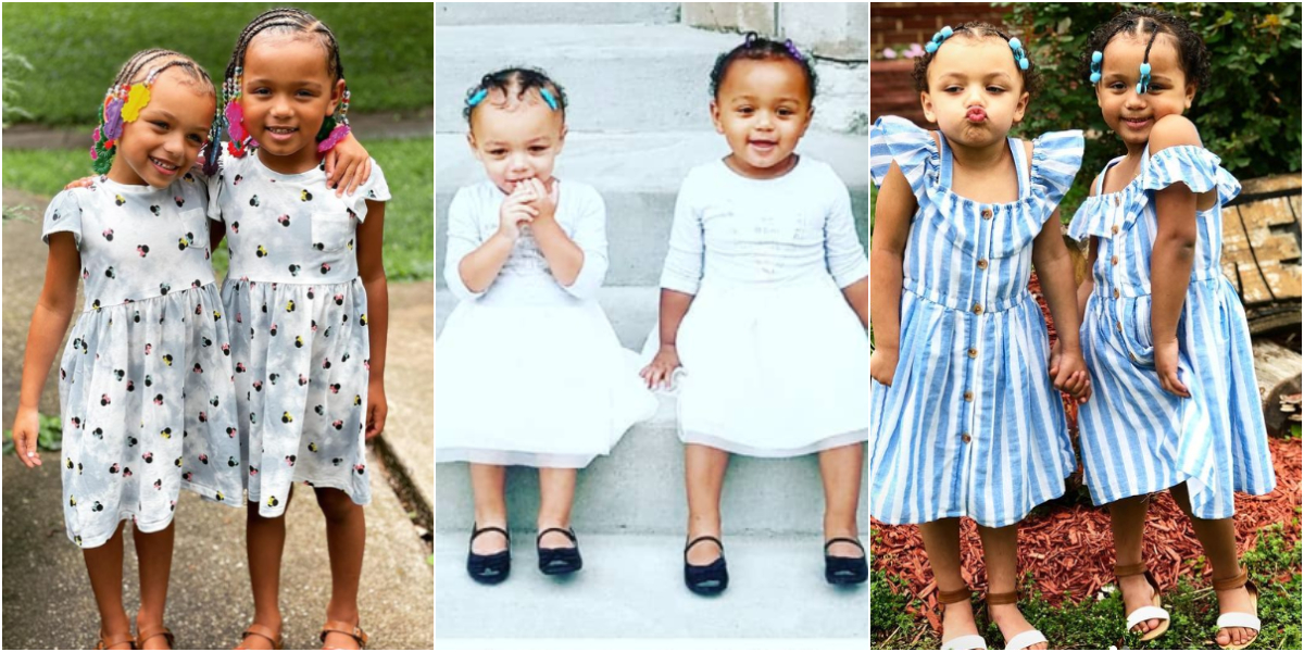 Kalani and Jarani: 5 photos of the twin sisters born with rare black and white skin colours