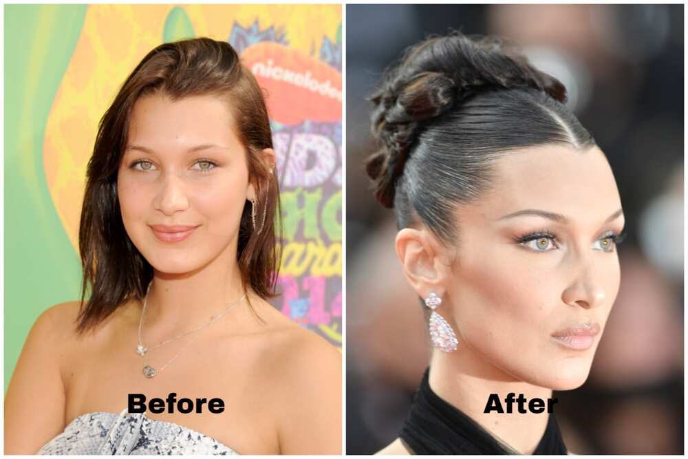 Bella Hadid before and after