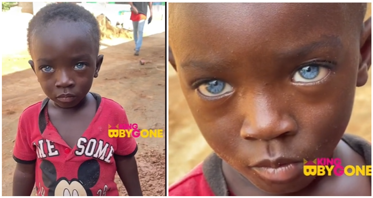 Ghanaian boy born with rare blue eyes wows many online, video surafces