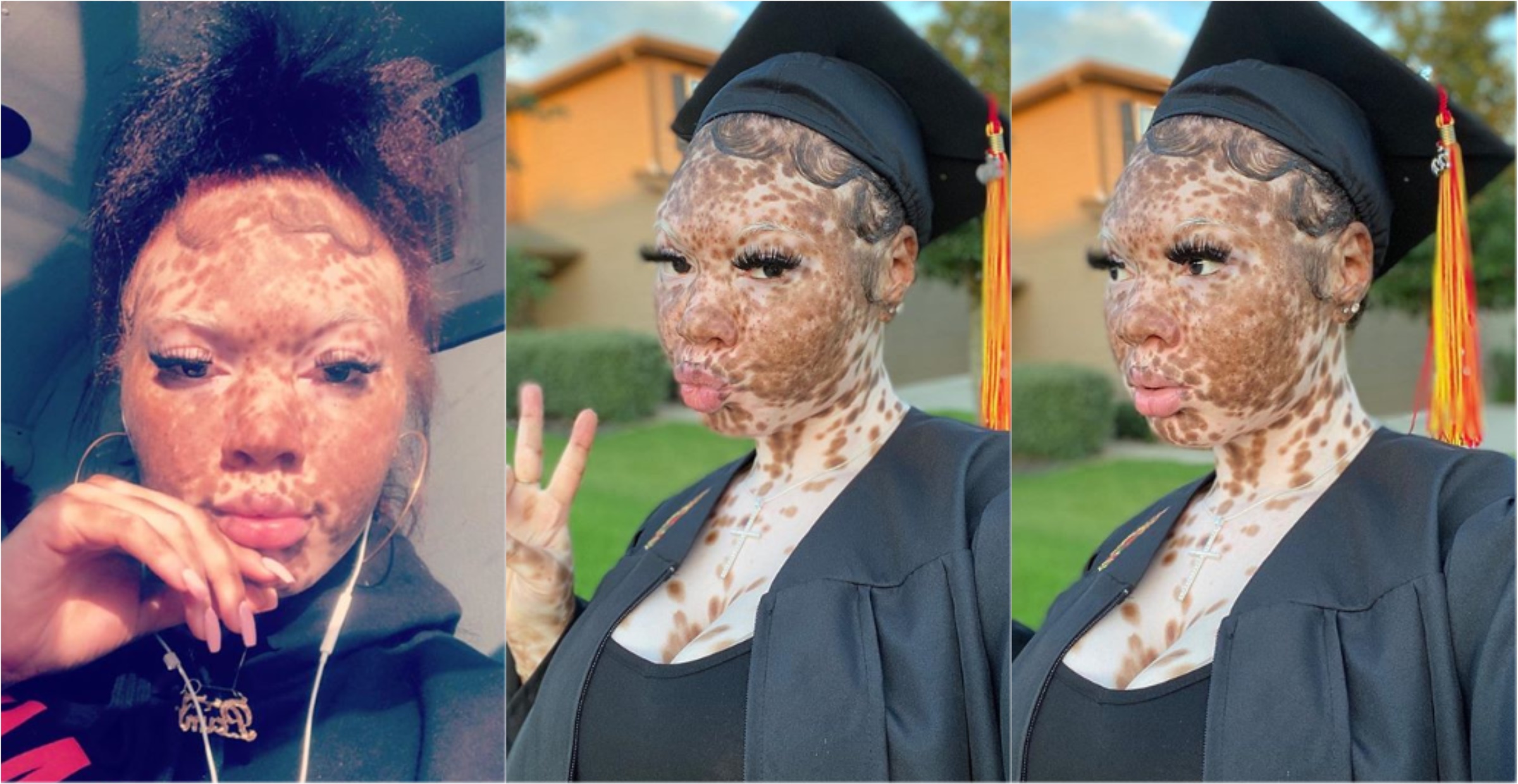 Pretty lady with unique black skin tone shares stunning graduation photos