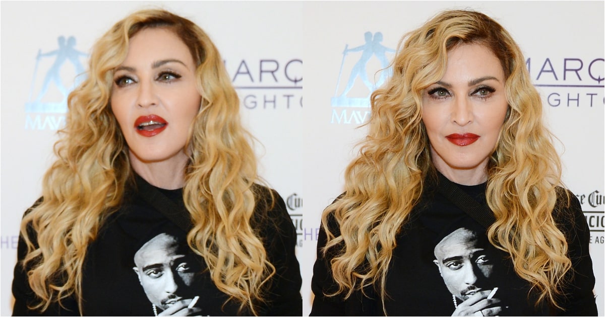 Madonna bravely shows off hip surgery scar to Instagram followers