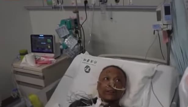 Chinese doctors who slipped into coma due to COVID-19 wake up with dark skin
