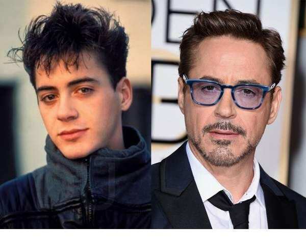 Celebrity blepharoplasty before and after