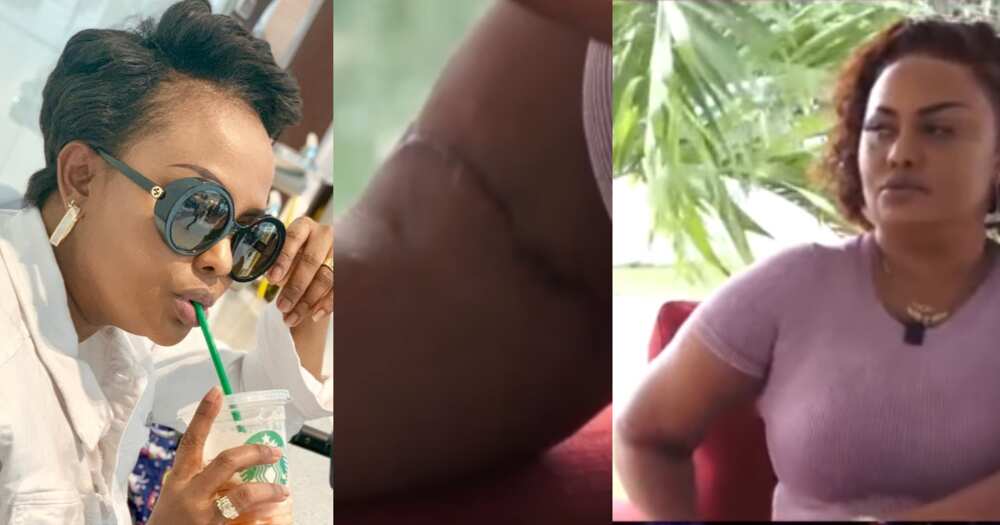 Nana Ama McBrown: Actress Shows Broken arm which was Replaced with Metal