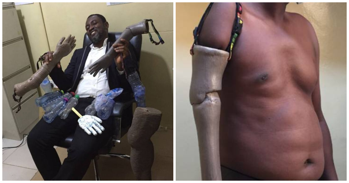 Photos of Ing Wireko-Brobby and his prosthetic arm innovation