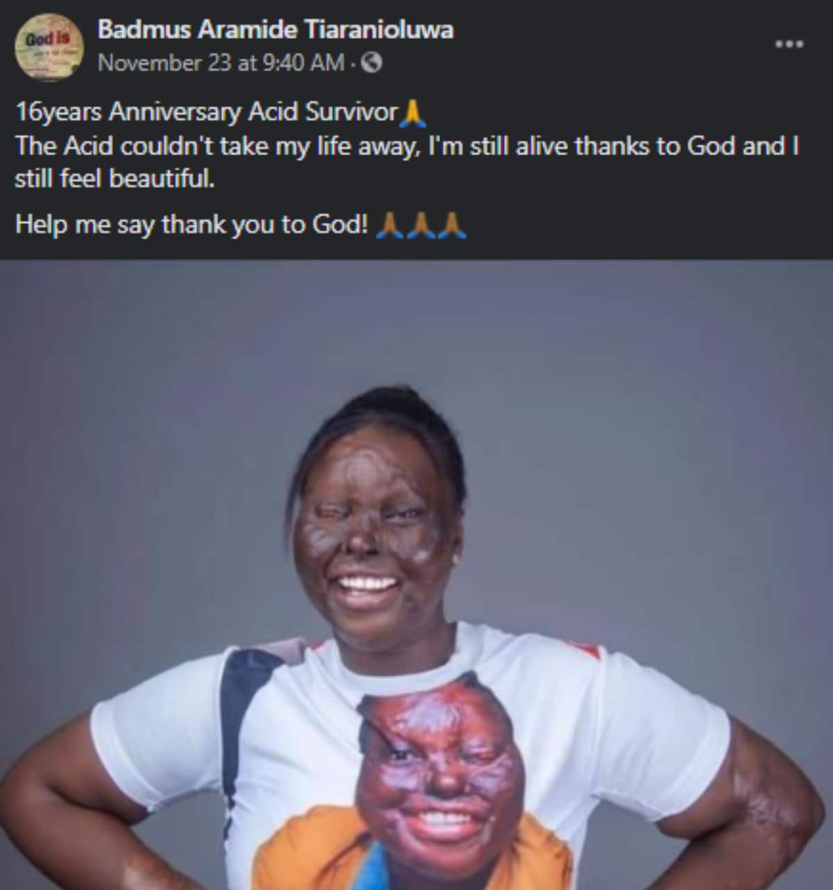 Nigerian acid survivor celebrates 16 years of being alive after unfortunate incident
