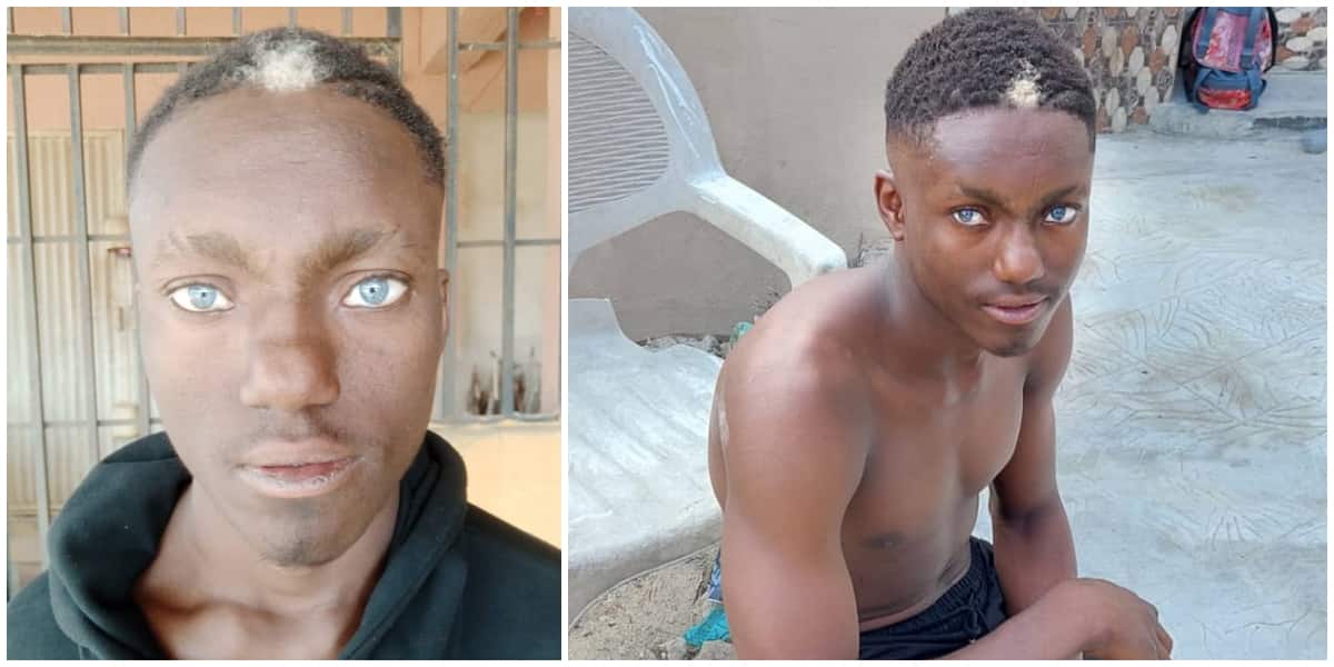 Photos of Nigerian man with natural frontal white hairs and light blue eyes causes stir on social media