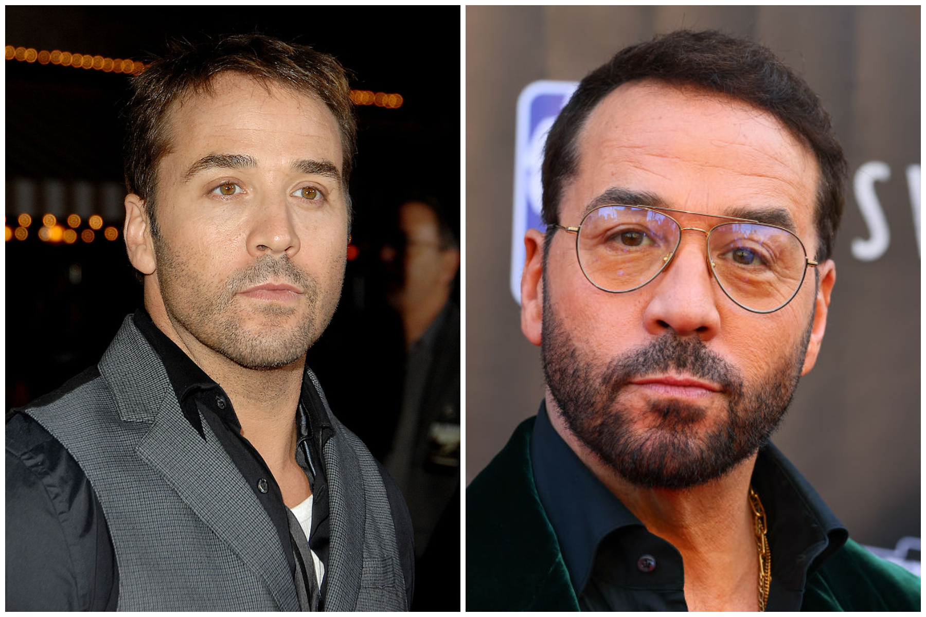 Hair transplant celebrities before and after