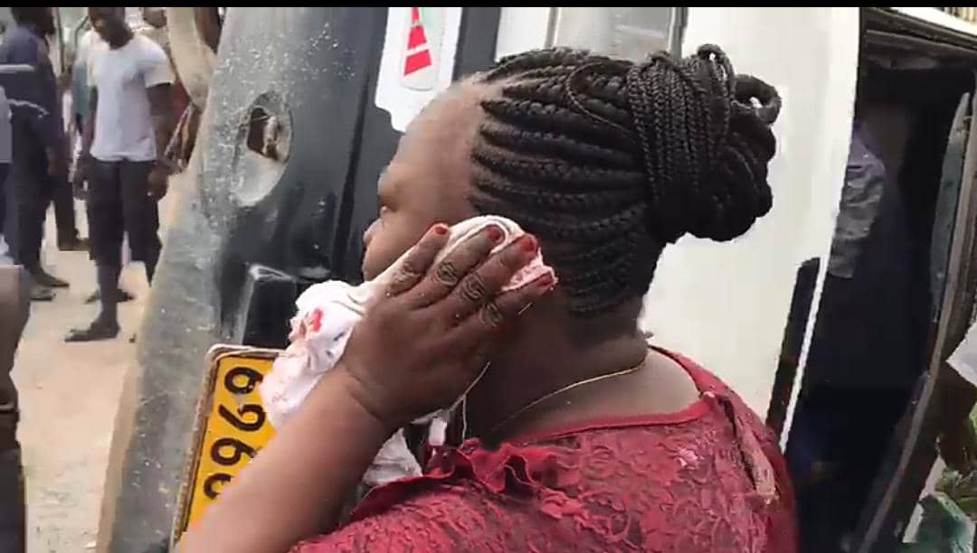 Another victim of the Kasoa-Mallam accident puts a white cloth to her ear.